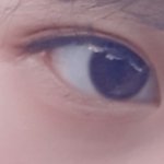 심각한 쌍꺼풀
