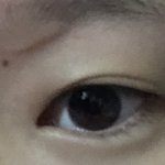 나 모기물린거 왜 이따<b>구임</b>