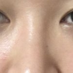 [댓글부탁해] 나너무 불안해 얘들아 나 코좀 봐주라