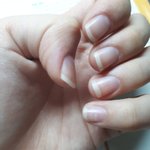 이런 <b>손톱</b>은 어떻게 다듬어야해?ㅠㅠ