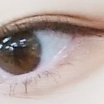 [댓글부탁해] 나 쌍수망했는데 재수술할까? 제발 봐줘ㅠㅠㅠㅠ