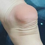 [댓글부탁해] <b>이고</b> 장용준 발바닥임 발바닥 뽀뽀하고싶디