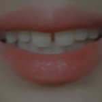 [혐주] 얘들아 나 <b>앞니</b> 거슬려?