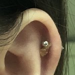 [드루와] 귀에 <b>진물</b> 굳었당