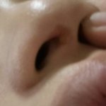 혐주의) <b>코에</b> 고름같이 뭐 나오는데 이거 뭐야?
