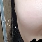 [드루와] 웃을때 얼굴에 <b>볼살</b> 갈라지는거??