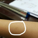 [댓글부탁해] 말티즈<b>샛기</b>가 물어서 흉졌음
