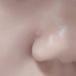 <b>코옆</b>에 뭐가났는데 살려줘...