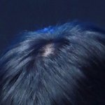 [댓글부탁해] 머리<b>탈모</b>인 아이돌 있어?