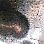 나 진짜안좋은 <b>버릇</b>있는데 심한거같니