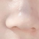 [조언부탁해] 볼에 여드름 <b>자국</b>? 진짜 어떡해야돼