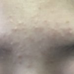 애드라 피부 안 좋은 사람 이거 꼭 써봐(혐주의)