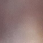 [사진잇음] 나 쌍수할건데 지방많아? 절개해야댈거<b>가태</b>?