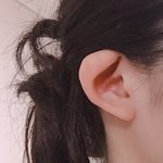 [댓글부탁해] 나 귀한쪽이 찌그러짐