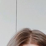 [급함] 야 나 ㄹㅇ 탈모왔다