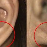 엄마 귓불에 주름 있으면 병원에 꼭 모시고 가야 하는 이유