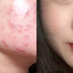 [드루와] 피부화장 <b>갭</b>차이ㅋㅋㅋㅋㅋㅋ