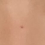 나 30분 뒤에 쌍수함 +쌍수+<b>눈매</b>교정 후기