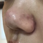 제 코 좀 살려주세요 (사진)
