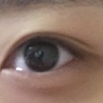 나 쌍수할까말까