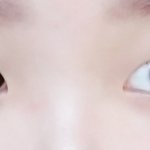 쌍수할까? 봐<b>쥬</b>라 ㅜㅜ