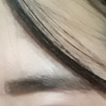 [댓글부탁해] 쌍수 <b>성공적</b>?