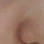 나 블랙<b>헤드</b> 개쩔엉