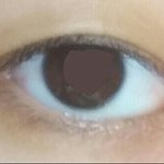 [댓글부탁해] 나 <b>눈</b> 뒤트임 해야될 <b>눈</b>임?