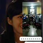 [댓글부탁해] 쌍수하거 스트레스 <b>조나</b>큰거
