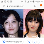 외국인들 한국연예인한테만 성형 어쩌고 하는거 어이없지않냐