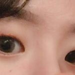 쌍수 할 말 ㅠ <b>이런눈</b> 쌍수하면 좋을까