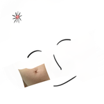 [ㅅㅂㅅㅂ] 여드름<b>압출</b>하고