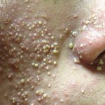 <b>우악</b> 이거바;;;;(혐짤주의)