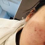 나 피부화장 <b>전후</b> 대박이다?