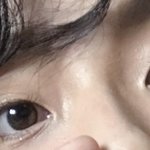 [조언부탁해] 사진추가+) 무쌍 쌍수 할까 말까ㅠㅠ