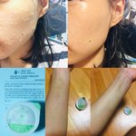 겨울 피부 관리 어떻게 하세요?