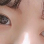 <b>쌍수</b> 망했어 죽고싶어(사진있음)