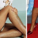 [10대의성] 털순이가 <b>제모</b>방법 알려줌