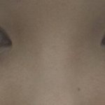 [댓글부탁해] 나 코성형 했는데 코 어때 ㅠ?