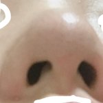 [댓글부탁해] 애들아 내 코 <b>복코</b> 심하냐 )사진잇오 혐주의