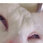 [댓글부탁해] 급) 쌍수2주차인데 붓기<b>심해</b>? ㅠㅠㅠ