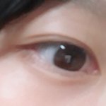 [조언부탁해] <b>쌍수</b>하려고하는데