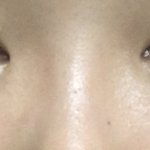 [댓글부탁해] 나 <b>코</b> 성형 했는데 <b>코에</b> 핸드폰 떨궜어..