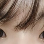 앞트임 해야하는 눈인가요?
