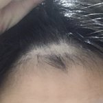 나 이거 <b>탈모야</b>??...