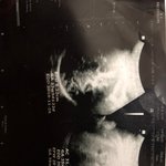 친구가̌̈ <b>임신</b>했다는데