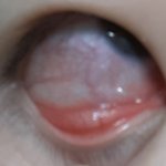 혐주의) 이거 눈 <b>실핏줄</b> 터진거야?..