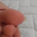 나 <b>엄지</b>발톱 기르는중임