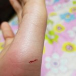 [댓글부탁해] <b>개</b>한테 물렸는데 <b>개주인</b>이