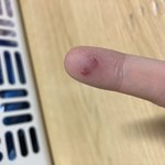 [드루와] ㅈㄴ아파 시쟐